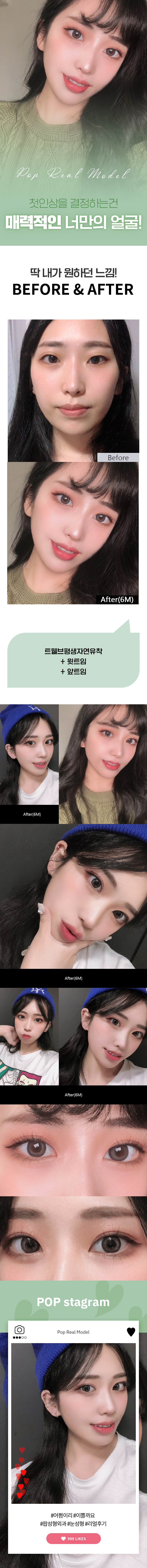 루디아6달.jpg