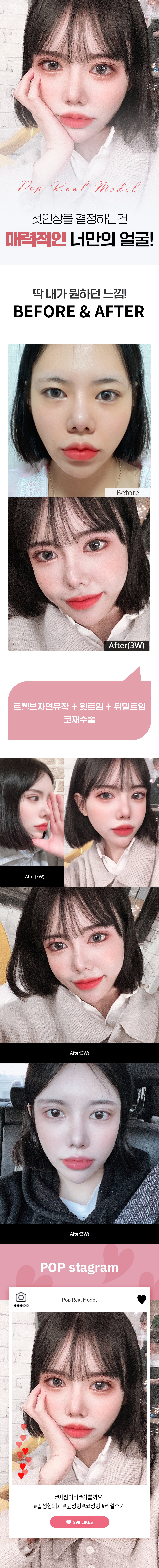 소은빈3주.jpg