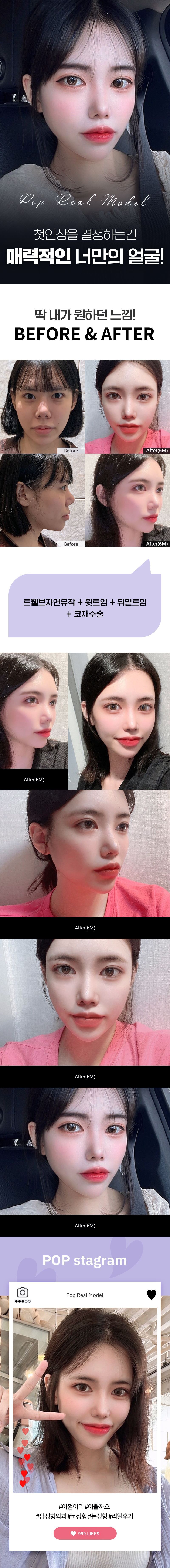 소은빈6M.jpg