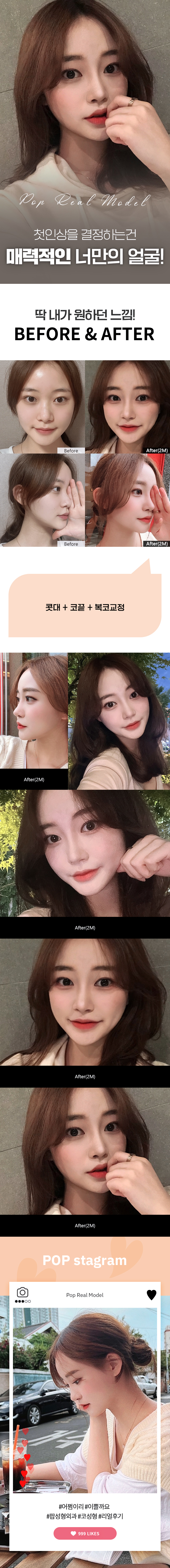 김채림2M.jpg