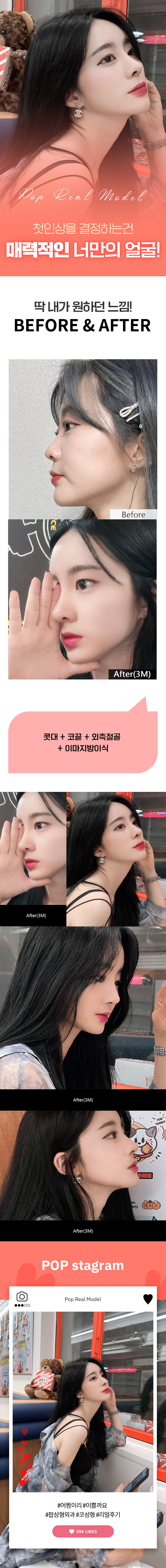 윤예지3달.jpg