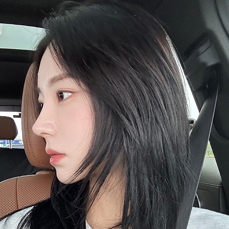 팝성형외과 복코 교정 코성형 2개월차 솔직후기입니다!