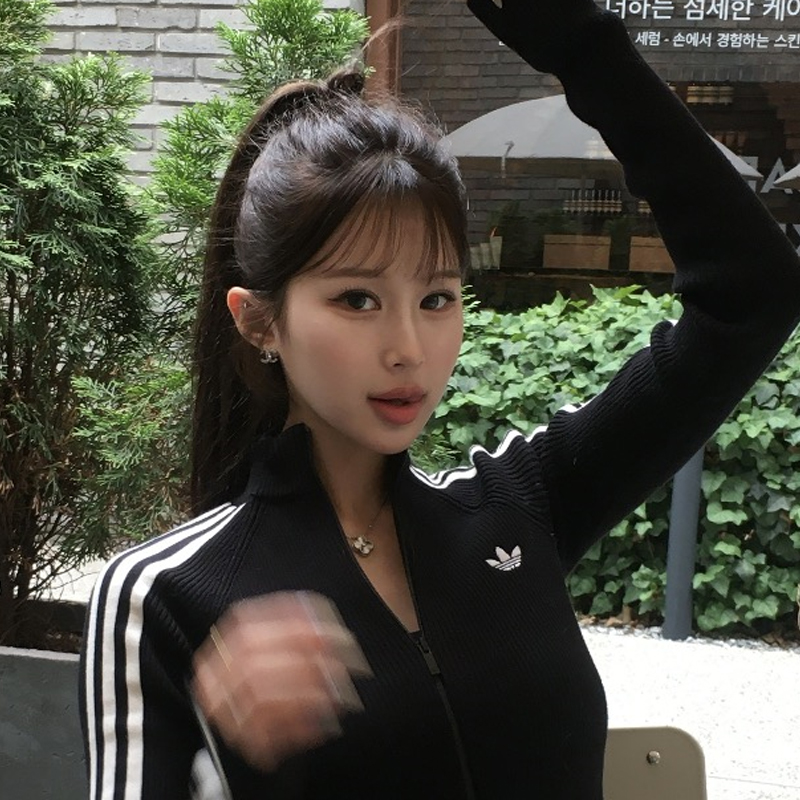 팝성형외과에서 12홀자연유착+윗트임 2개월차 후기입니다~!