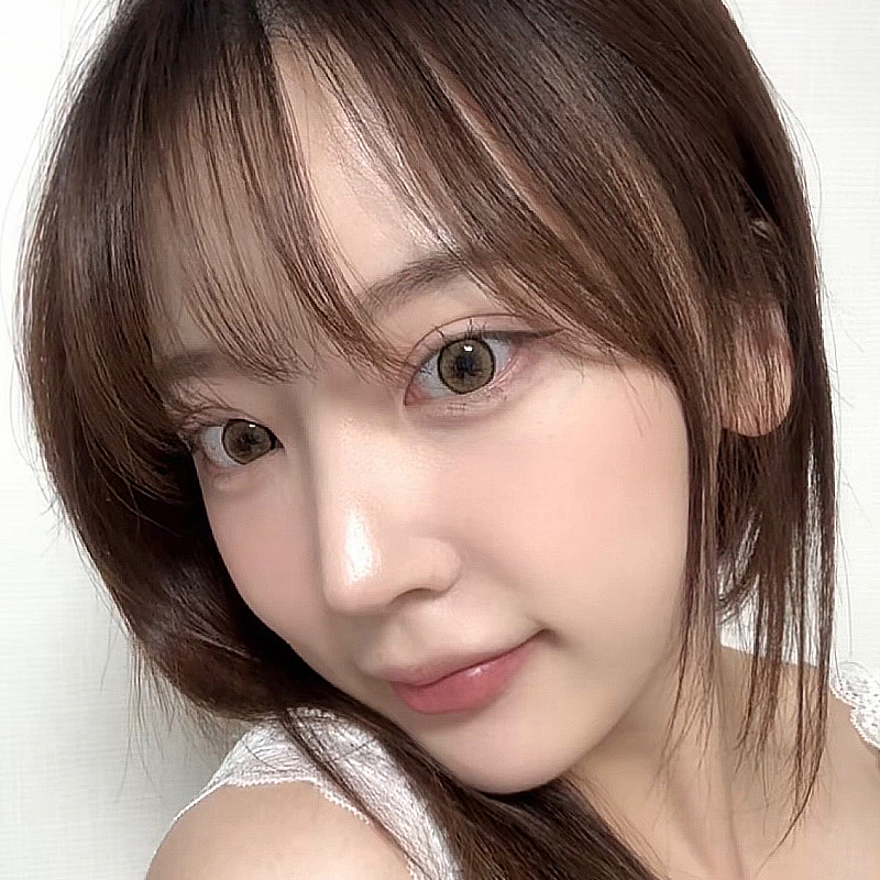 팝성형외과 12홀 자연유착, 눈밑지방재배치 1개월차 후기 입니다!
