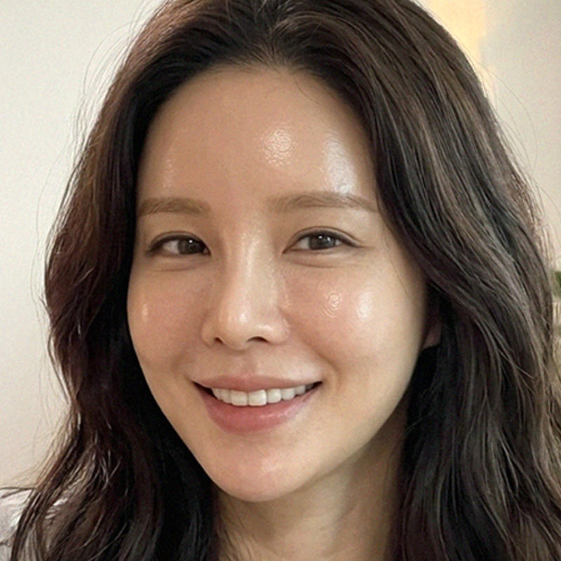 팝성형외과에서 미니거상 2개월차 후기입니다.