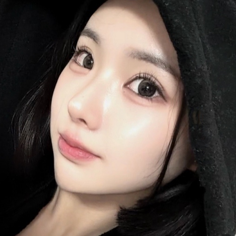 팝성형외과 12홀 자연유착+눈매교정+윗트임+앞트임+뒤트임+밑트임 1개월차 후기