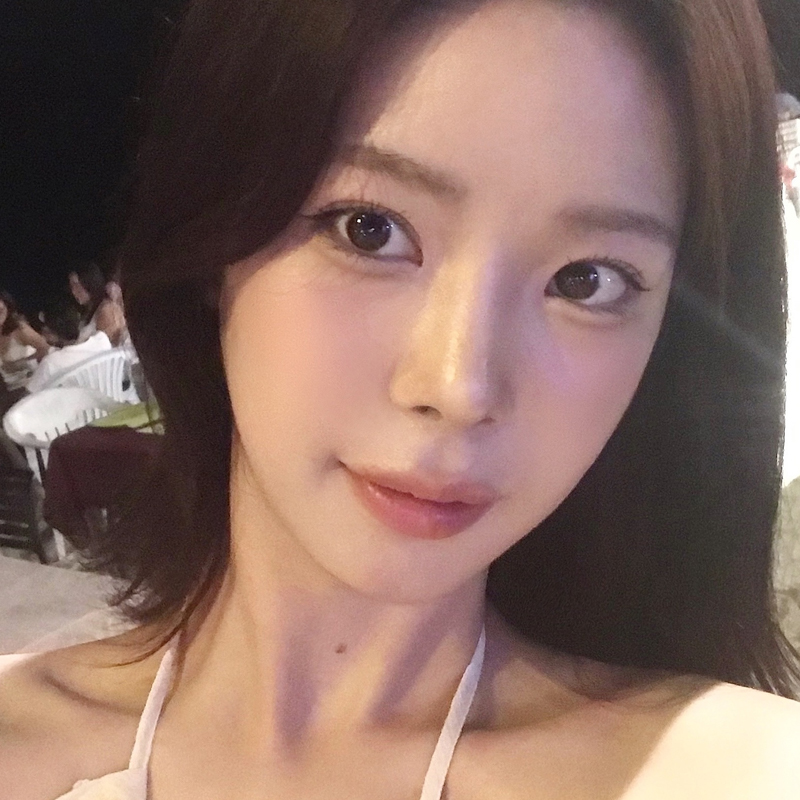 팝성형외과에서 12홀 자연유착+앞트임+윗트임+뒤밑트임 4개월차 후기입니다!