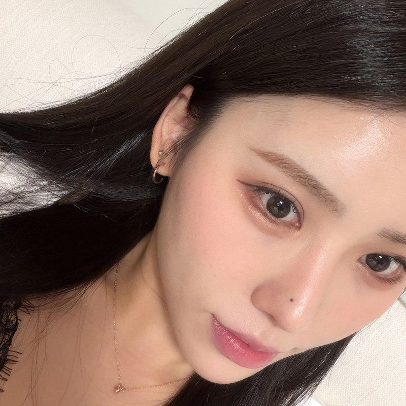 팝성형외과 절개 쌍꺼풀 눈재수술 1개월차 후기