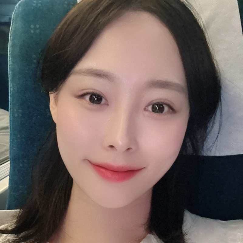팝성형외과 12홀 자연유착+눈매교정+윗트임 1개월차 후기