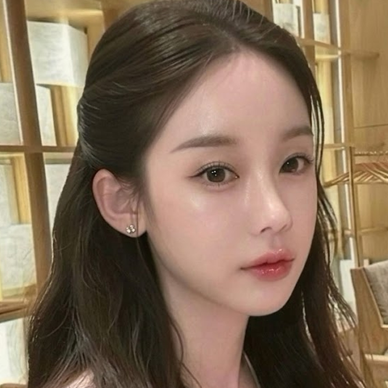 팝성형외과 12홀자연유착+뒤밑트임+눈위지방이식 4개월차 후기!