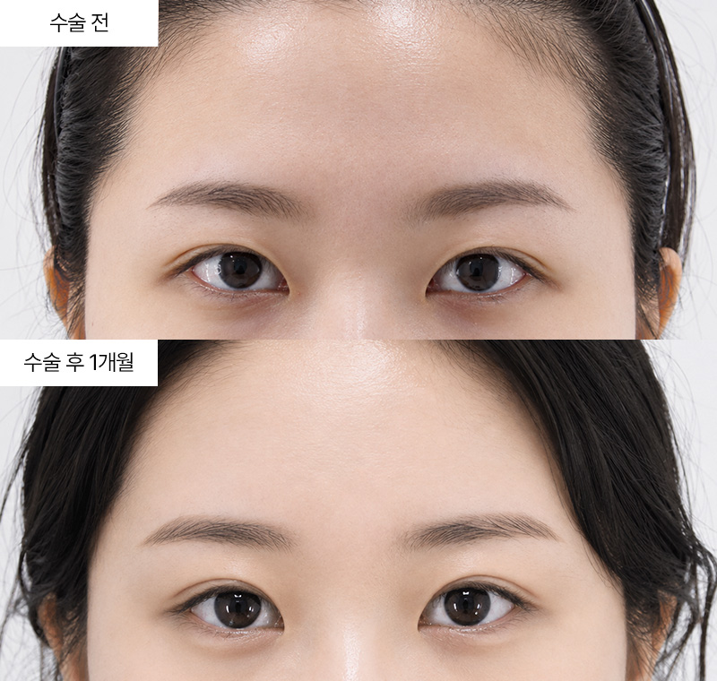 이마거상