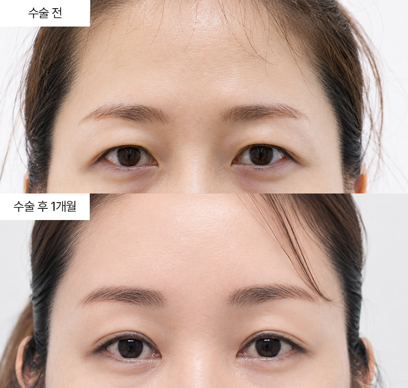 이마거상