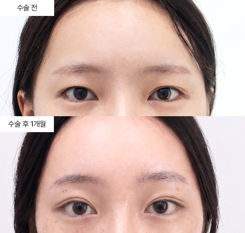 이마거상