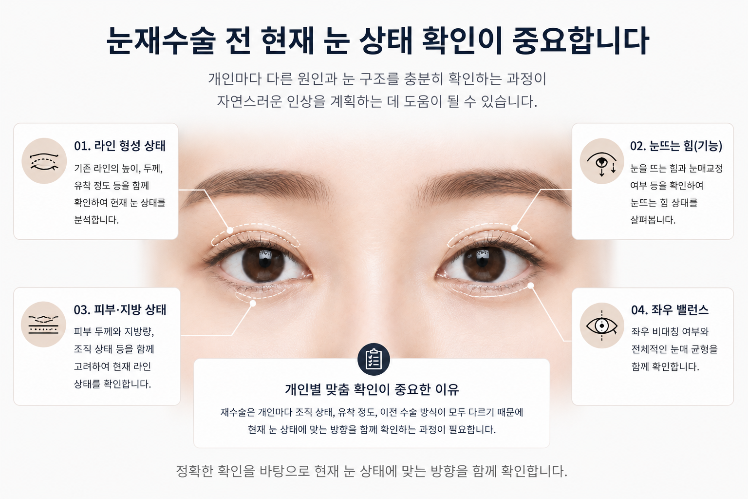 [눈 성형 전담센터] 눈재수술, 너무 빨리 결정하면 안 되는 이유가 있습니다