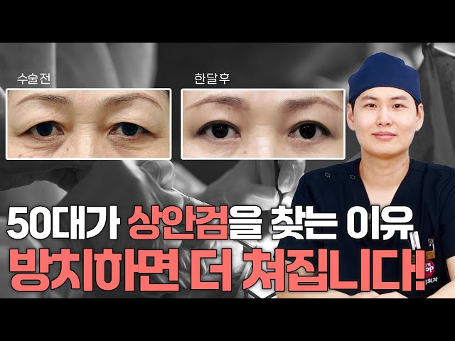 [눈 성형 전담센터] 50대 눈꺼풀 처짐, 쌍꺼풀 수술이랑 다릅니다