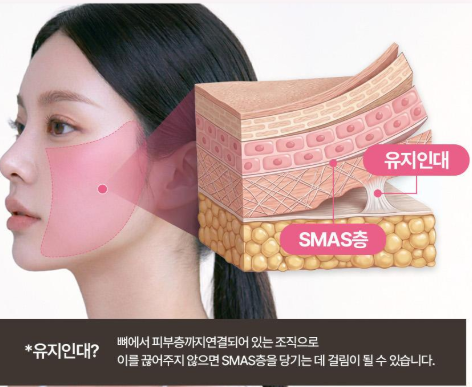 [리프팅 전담 센터] 안면거상술, 수술 전에 꼭 알아야 할 핵심 정보