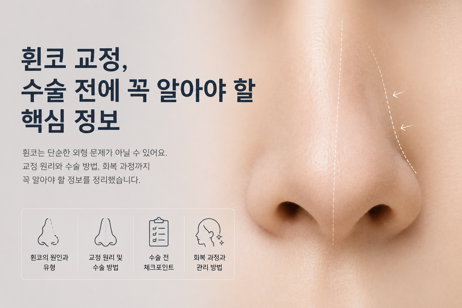 휜코 교정, 수술 전에 꼭 알아야 할 핵심 정보