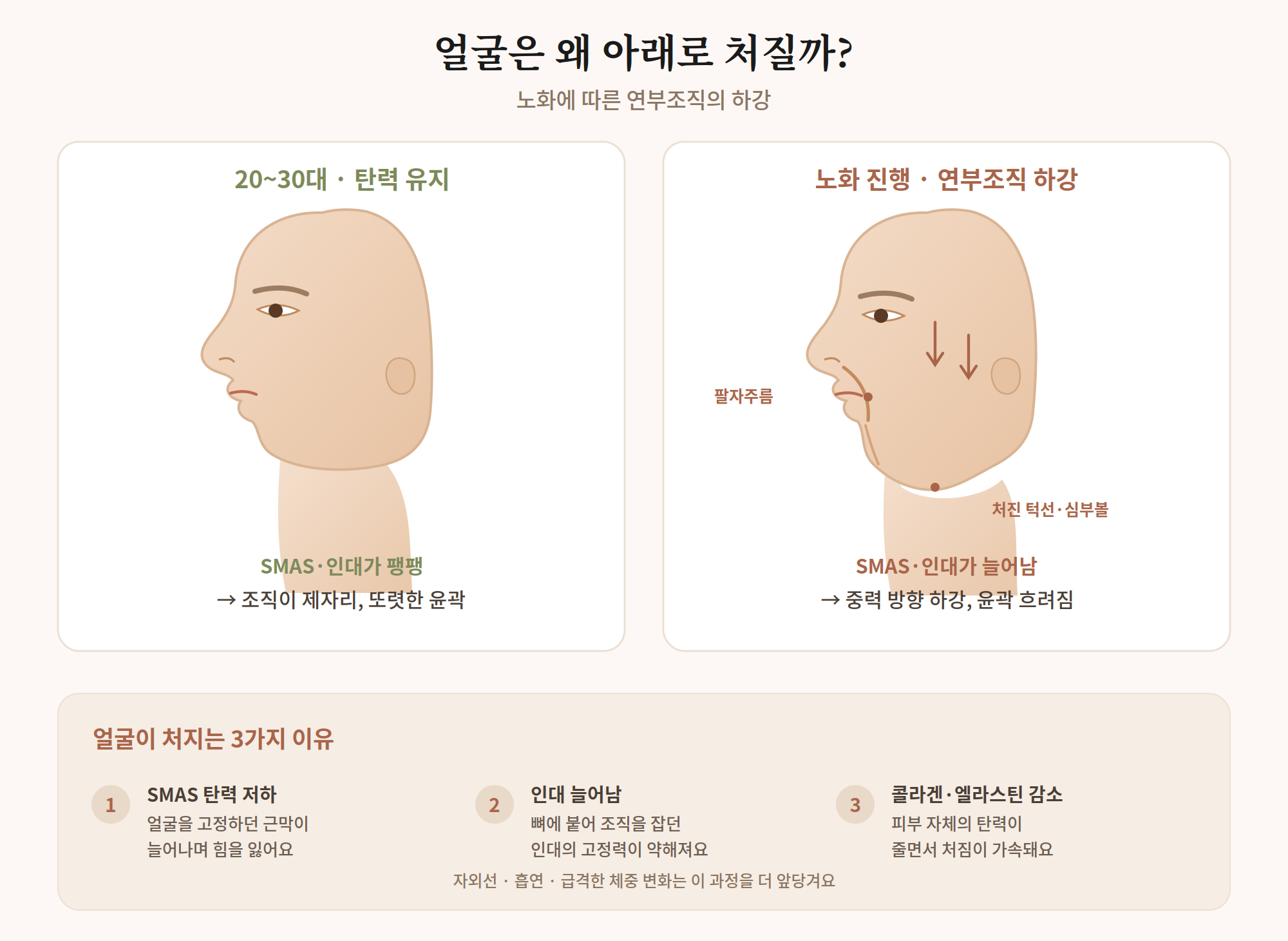 안면거상, 왜 얼굴이 처지는 걸까요?