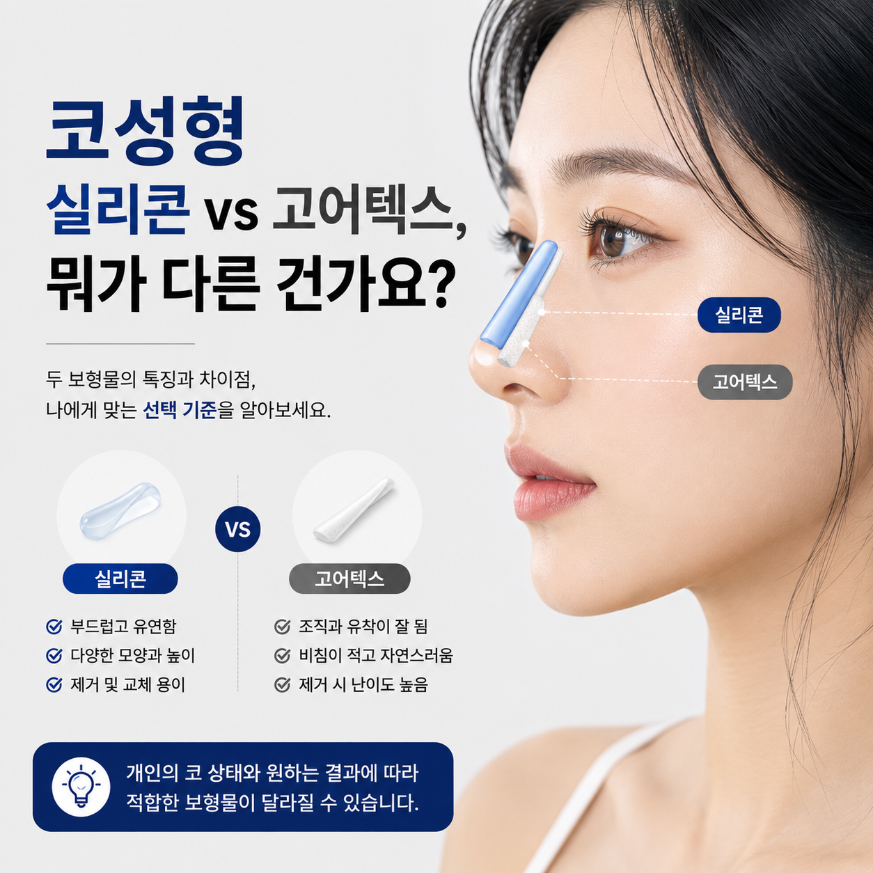 코성형 실리콘 vs 고어텍스, 뭐가 다른 건가요?