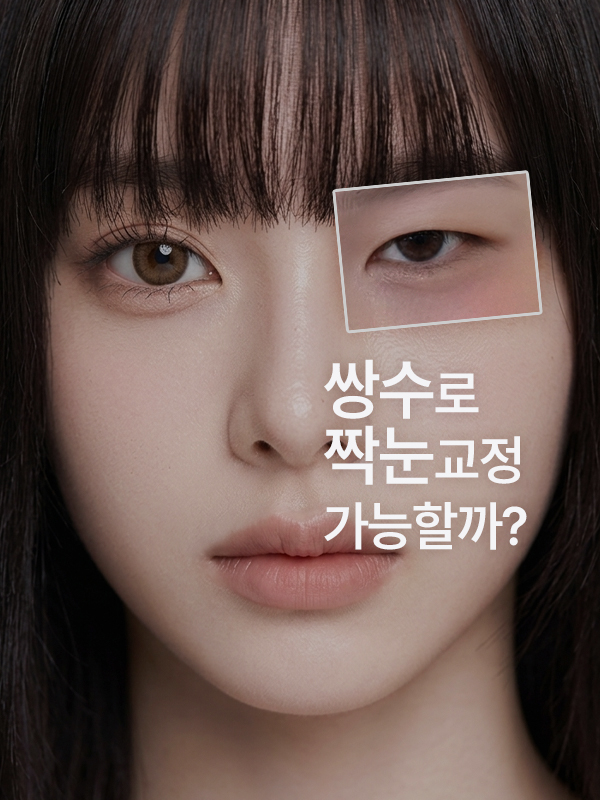 짝눈인데 쌍꺼풀 수술로 양쪽 눈을 비슷하게 만들 수 있나요?