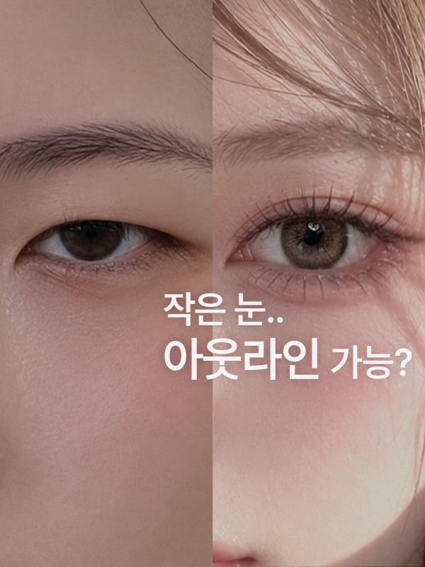 눈이 작은 편인데 아웃라인 쌍꺼풀을 해도 자연스러울까요?