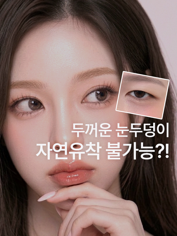 눈꺼풀이 두꺼워도 자연유착 쌍꺼풀 수술이 가능할까요?