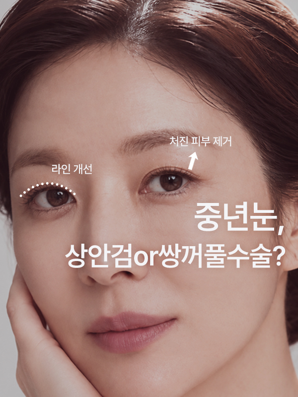 중년, 쌍꺼풀 수술과 상안검 수술은 어떻게 다른가요?