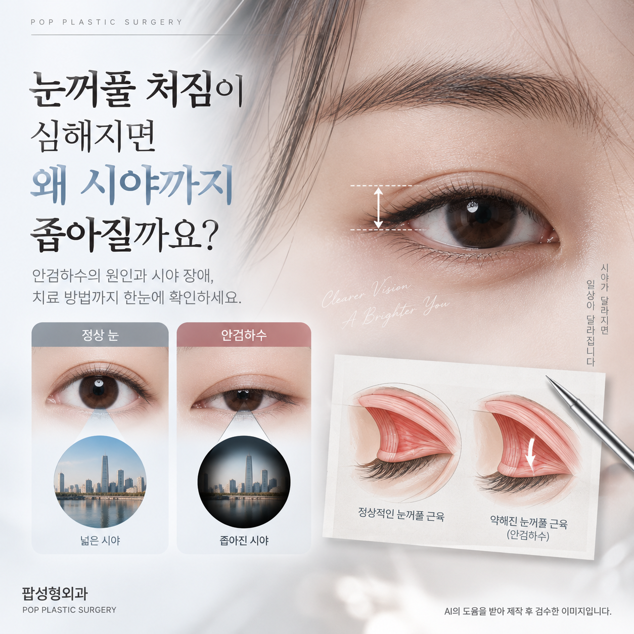 눈꺼풀 처짐이 심해지면 왜 시야까지 좁아지는 걸까요?