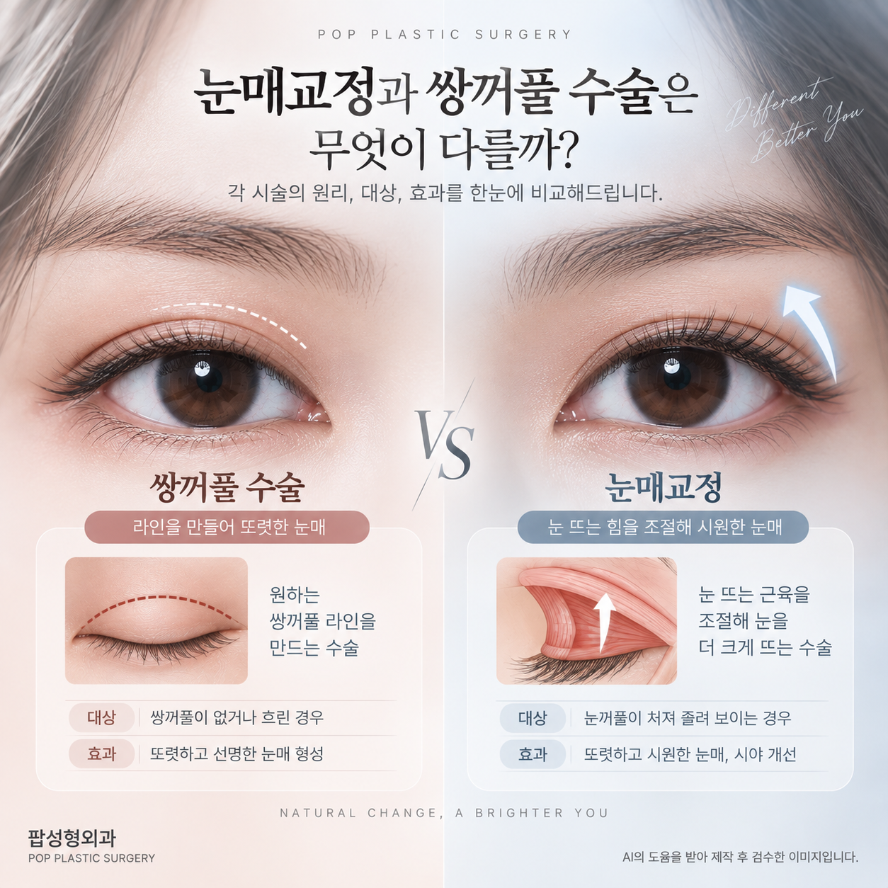눈매교정 방법은? 쌍꺼풀 수술이랑 어떤 차이가 있나요?