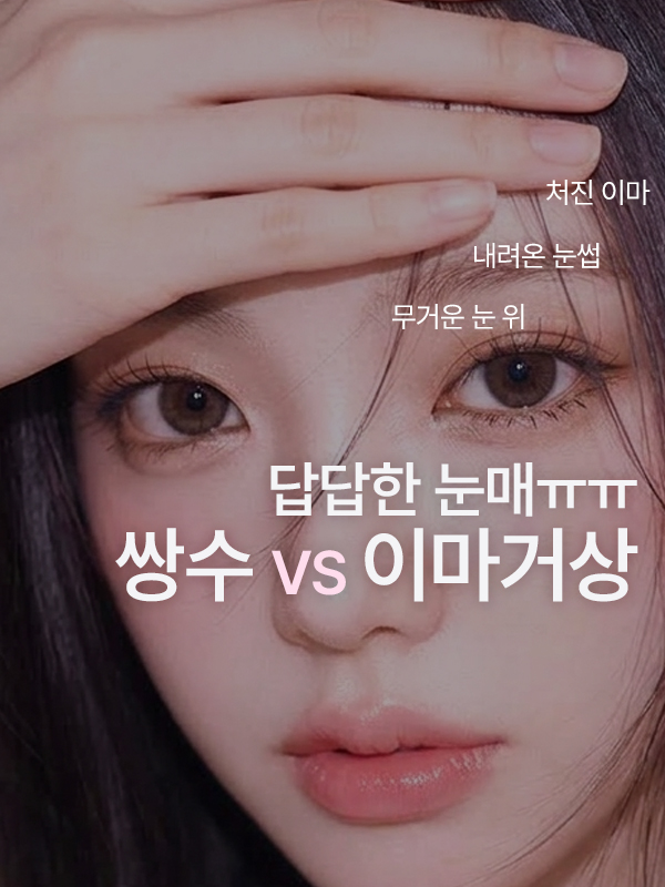 눈썹이 처지면서 눈이 답답해 보여요. 쌍꺼풀 수술보다 이마거상이 맞을까요?