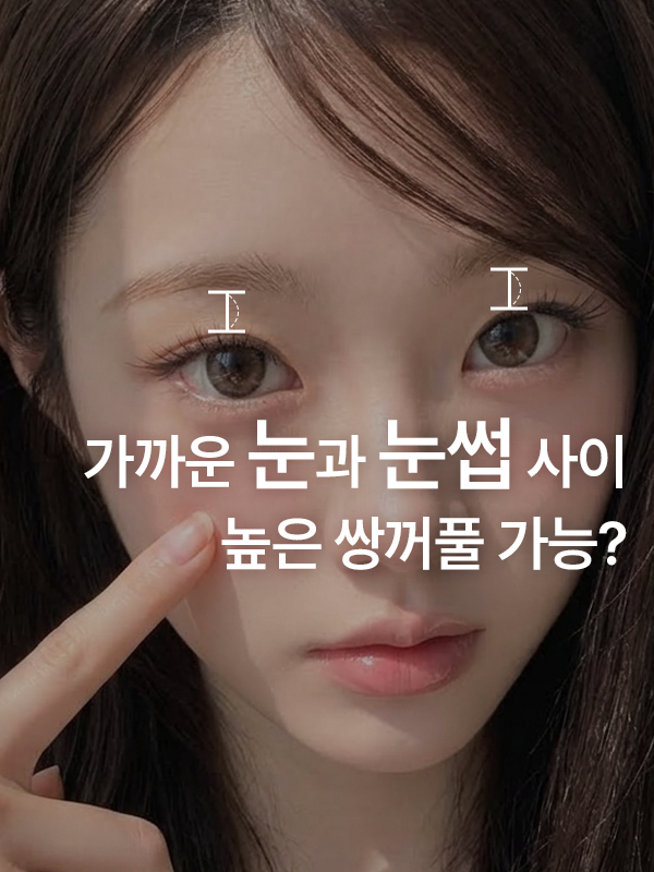 눈썹과 눈 사이가 좁으면 높은 쌍꺼풀이 어색할까요?
