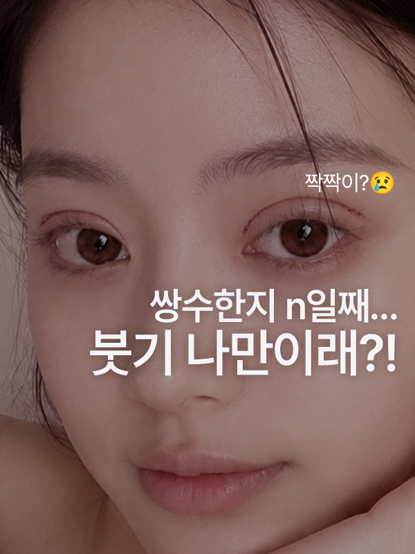 쌍꺼풀 수술 후 붓기가 안 빠지는 것 같아요, 정상인가요?