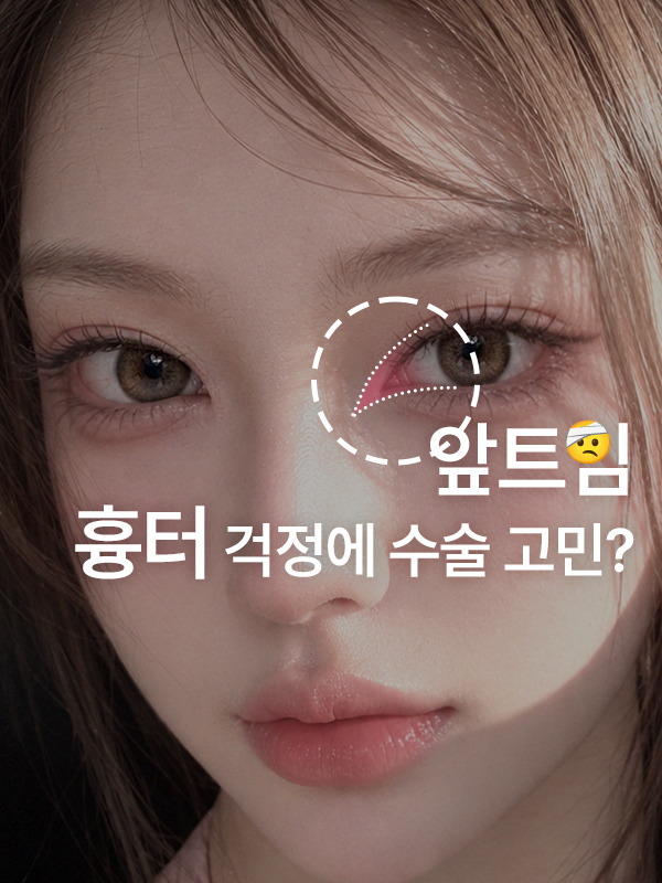 앞트임 흉터, 시간이 지나면 옅어질 수 있나요?