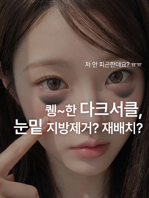 다크서클이 심한데 눈밑지방제거보다 눈밑지방재배치가 적합할까요?