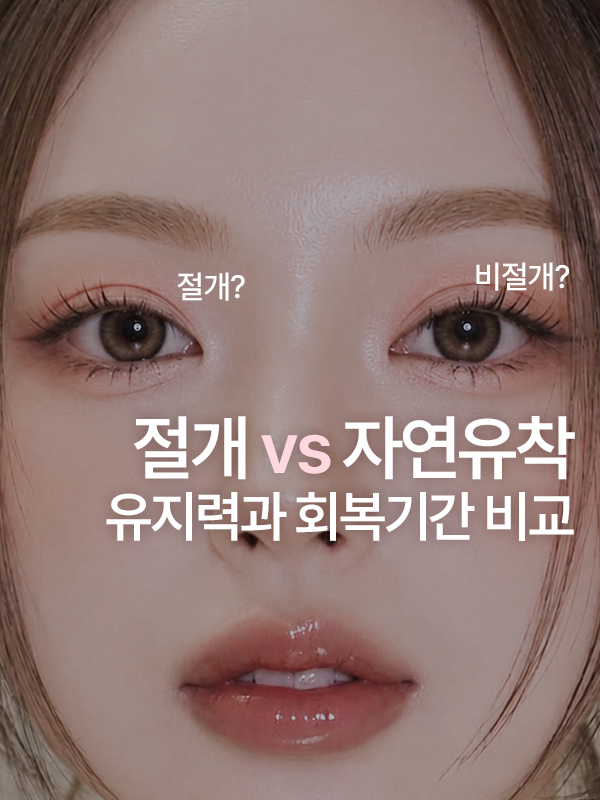 절개 쌍꺼풀 수술은 자연유착보다 덜 풀릴까? 유지력과 회복기간 비교