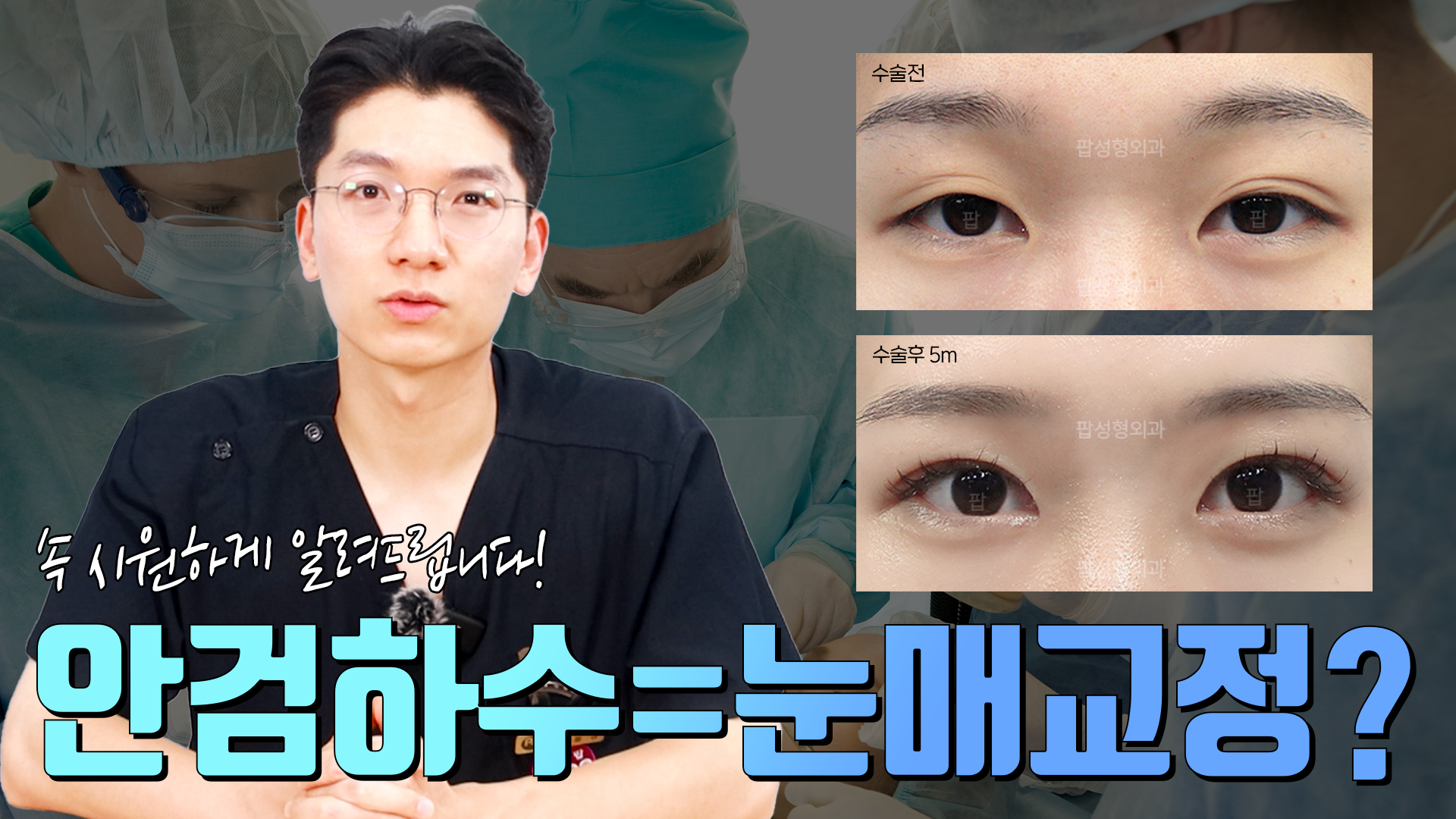 안검하수 눈매교정