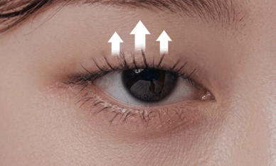 팝성형외과 눈매교정