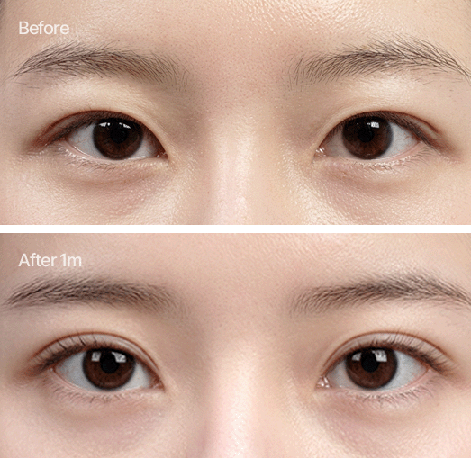 라인이 낮거나 마음에 안드는 경우 