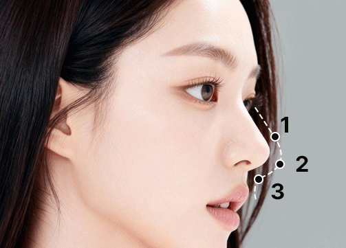 팝 코성형 디테일