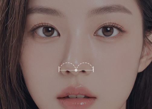 팝 코성형 디테일