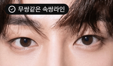 무쌍같은 속쌍라인